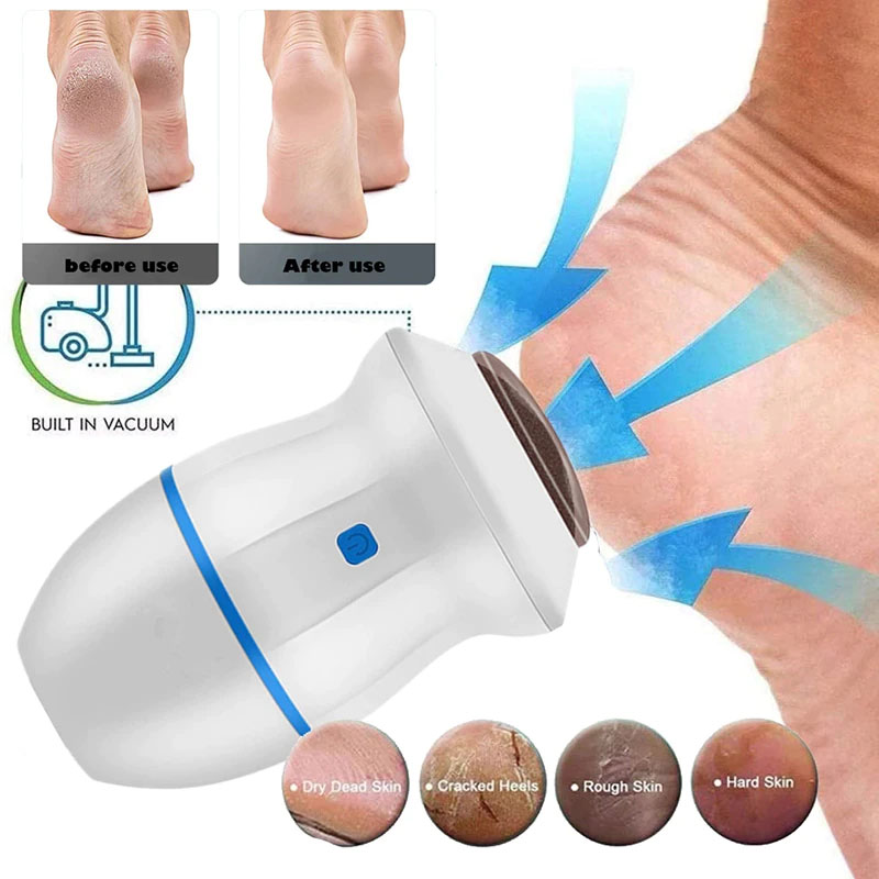 Electric Vacuum Foot Grinder